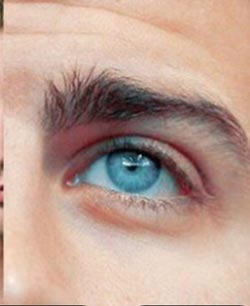 Eye Puffiness Emergency Patch